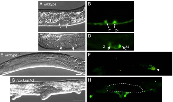 Fig. 2. Expression of lag-2::GFP in wild-type and hpl-1;hpl-2 developing gonads. Left, DIC; right, fluorescence