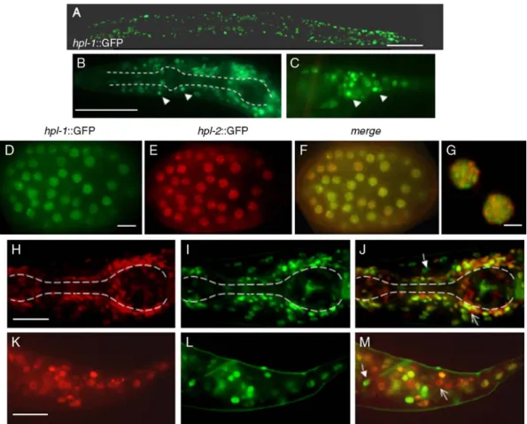 Fig. 5. hpl-1::GFP expression in live animals. (A) Hermaphrodite young adult showing ubiquitous nuclear hpl-1::GFP expression
