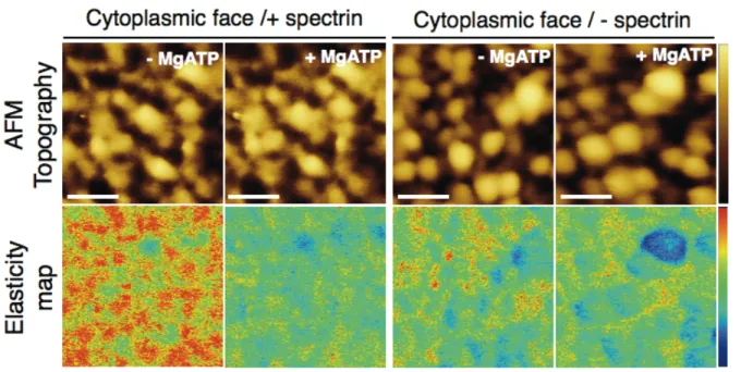 Figure  6.  MgATP  effect  on  the  topographic  (top)  and  elasticity  (bottom)  maps  of  the  RBC  cytoplasmic membrane in samples preserving spectrin network (+ spectrin) (right) and samples  where spectrin network was removed (- spectrin) (left)