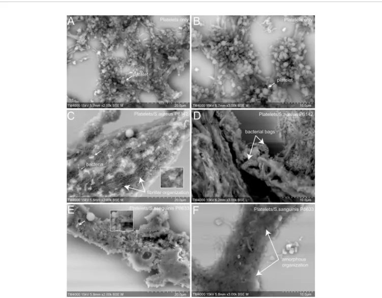 FIGURE 4 | Scanning electron microscopy of uninfected platelets and platelets–bacteria aggregates