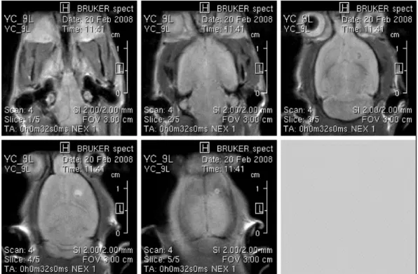 Fig. 2. Magnetic resonance image sample of tumors 5 days after 9L cell implantation.