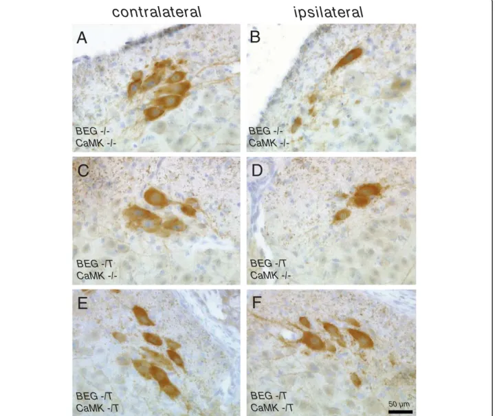 Figure 4 Examples of the histological evaluation of CHAT positive cells in the ventral horn of the lumbar spinal cord of neonatal mice after sciatic nerve axotomy