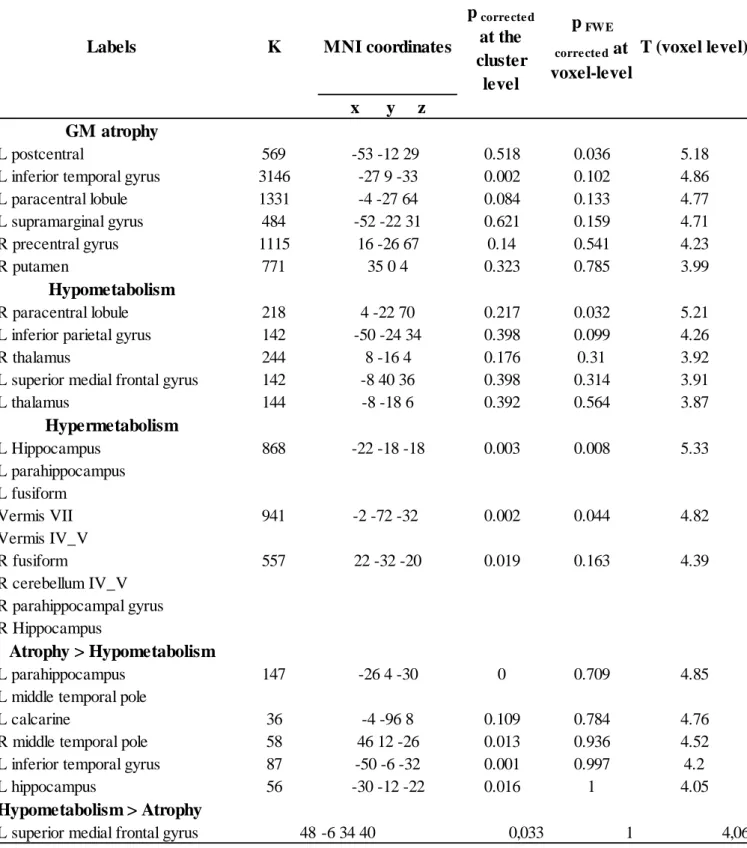 Table 2 Labelization. MNI coordinates. Cluster size in number of voxels and T value of the significant peaks  for  the  SPM  analyze  of  GM  atrophy,  hypometabolism,  hypermetabolism  and  GM  atrophy  &gt;  