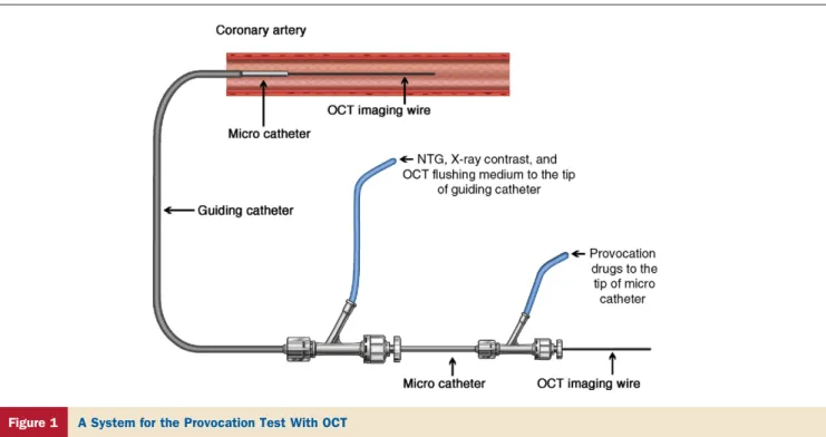 Figure 1 A System for the Provocation Test With OCT