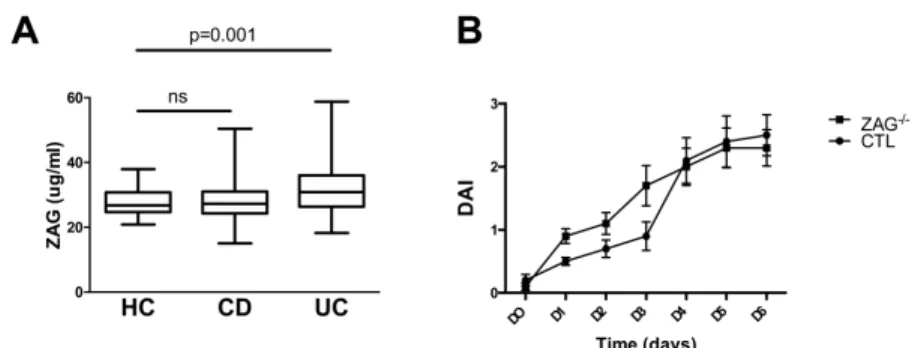 FIGURE 1.  A, ZAG protein level is elevated in UC patients. Plasmatic levels of ZAG were meas- meas-ured by ELISA in UC (n = 70), CD (n = 109), and healthy controls (n = 105)