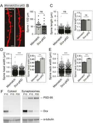 Figure 6. Postnatal knockdown of Dcx induces a simpliﬁcation of the dendritic arbor. (A) Schematic of the experimental timeline