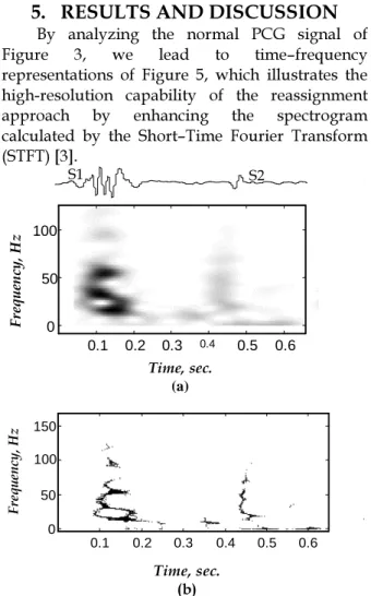 Fig. 5 – (a) STFT Spectrogram and (b) Reassigned–