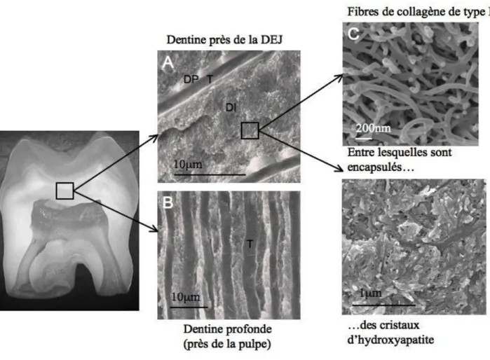 Figure 1.7 Structure dentinaire : du macroscopique au nanoscopique.  T : tubules, DP : dentine  péri-tubulaire, DI : dentine intertubulaire