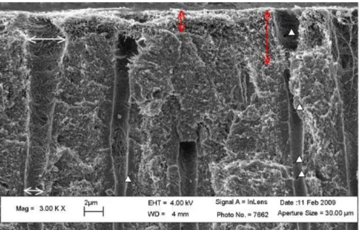 Figure  1.16.  Image  électronique  de  dentine  déminéralisée  en  surface  à  l’acide  orthophosphorique (à 37%)