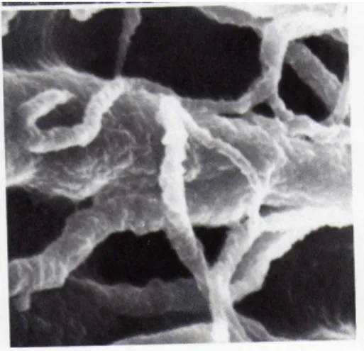 Figure 1. 17 Grossissement de la micrographie au MEB montrant l’infiltration de la résine dans  un tubule dentinaire et ses embranchements