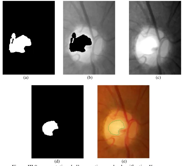 Figure III.9.segmentation de l’excavation par la classification K-means