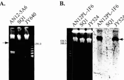 Figure 2.4.  Tri  field gel (PFG) 