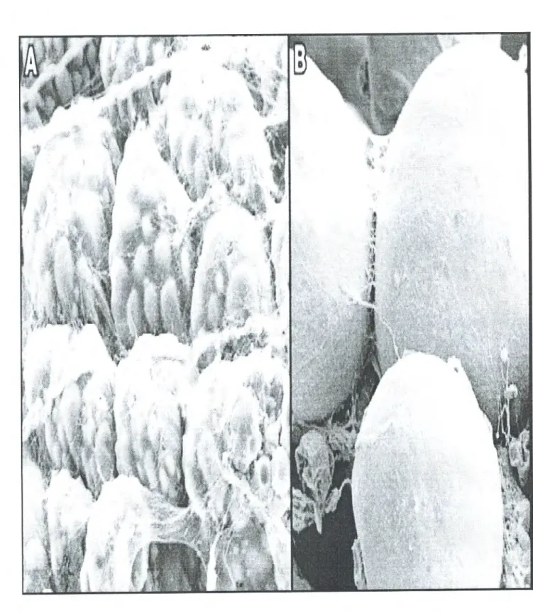 Figure 5.  Microscopie électronique à balayage de tissu adipeux brun et blanc (Frontini, 2010)