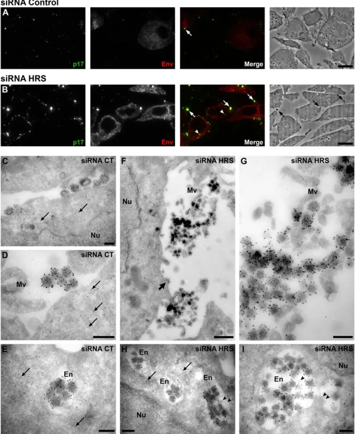 Figure 3. Silencing of HRS leads to accumulation of HIV-1 particles in at the cell surface and in endosomes