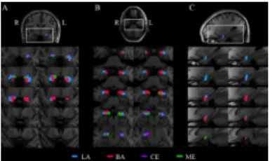 Figure 1. Tractographic segmentation in an example subject