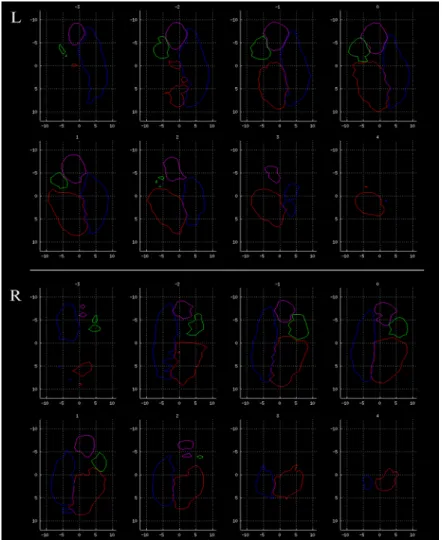 Figure 4. Amygdala tractographic segmentation atlas