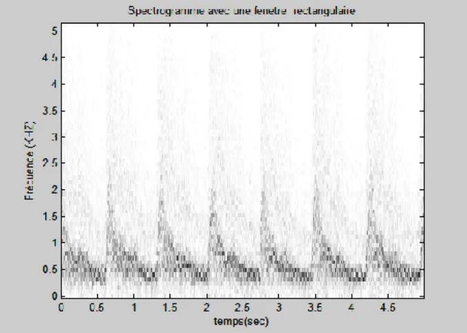 Figure 4.4.a.  Représentation temps-fréquence du signal Doppler de l’artère carotide  (Cas normal) 