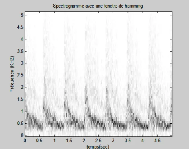 Figure 4.6.a. Représentation temps-fréquence du signal Doppler de l’artère carotide  (Cas normal)