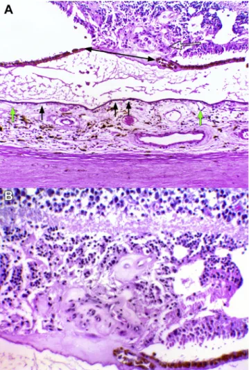 Figure 14. Light microscopy images showing histopathologic analysis of type 3 neovascularization