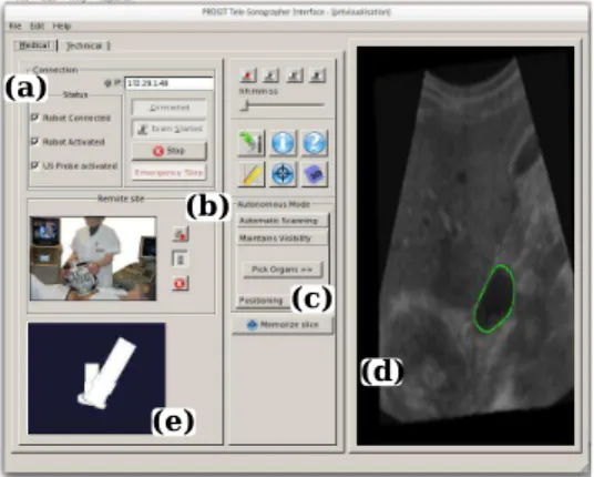 Fig. 4. The telesonographer GUI at the master site.