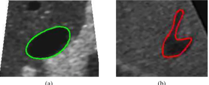 Fig. 5. Snake feature tracking in US images: (a) contour detection of convex and (b) concave objects.