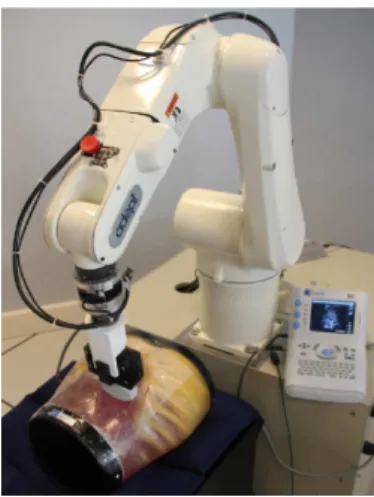 Fig. 7. The first experimental setup is composed by a 6-DOF anthropomorphic Viper (Adept) robot holding a US probe that interacts with a realistic abdominal phantom