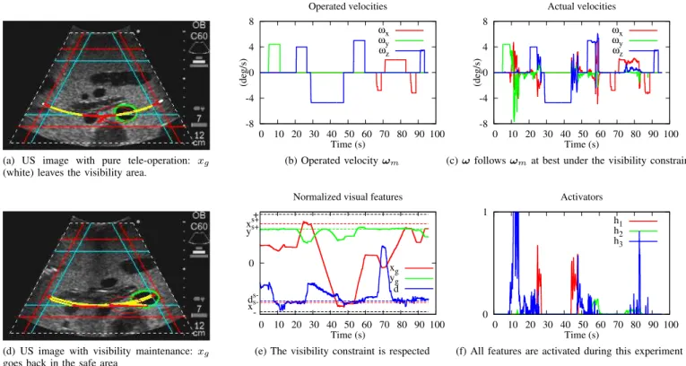 Fig. 8. Results on the real phantom. US image (a) without and (d) with the control law
