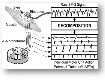 Figure  I.7: Décomposition d’un signal EMG brute résulte des TPAUMs  individuelles [36]