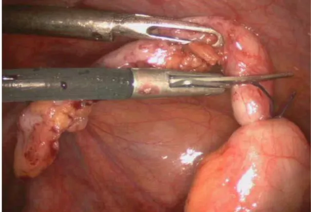 Figure 08   : section de l’appendice 