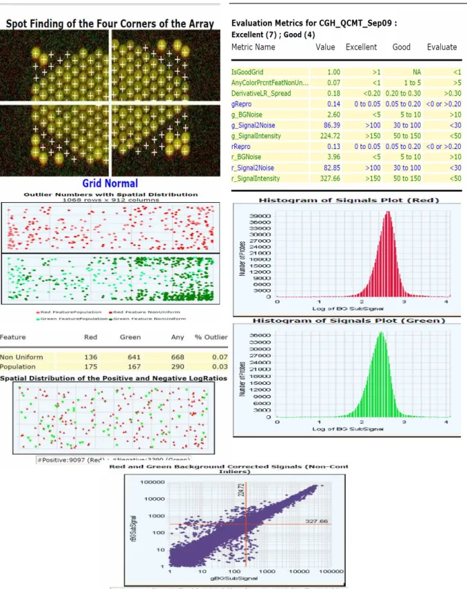 Figure  9  :  Rapport  de  contrôle  qualité  avec  les  différents  paramètres  permettant  d’analyser  la  qualité de la lame d’ACM-1M-DIS 