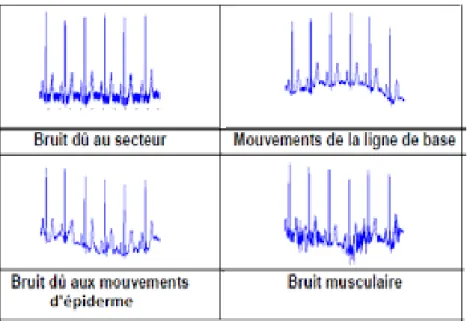 Figure 1.5 exemples de bruits techniques   