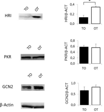 Figure  25:  Expression  des  trois  kinases  d’eIF2α, PKR (double-stranded RNA-activated  protein  kinase,  GCN2  (general  control  non-repressed  2)  et  HRI  (heme-regulated  eIF2alpha kinase) dans les cellules TO et OT