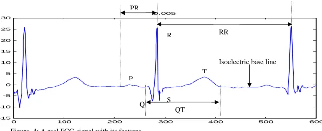 Figure 6 shows the CWT of an ECG signal with two  different SNR levels: a medium SNR portion of ECG  signal from the 1 st  sample to around the 1200 th  sample,  and a high SNR portion of ECG signal from around  1200 th  sample to the end of the record