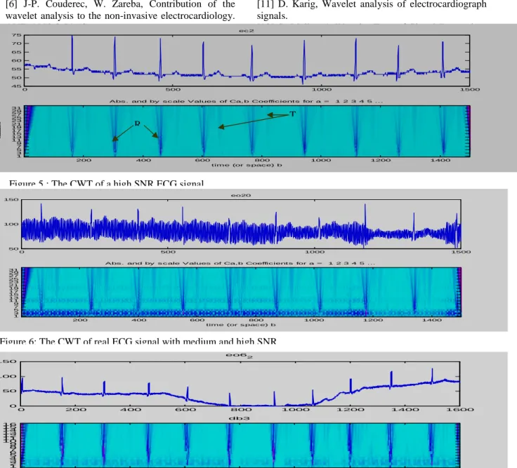 Figure 5 : The CWT of a high SNR ECG signal