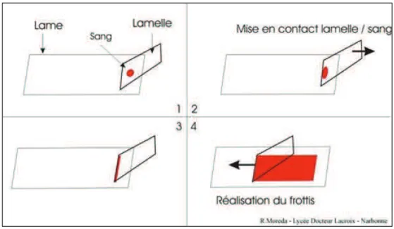 Figure 1.1. : Description des différentes étapes pour la préparation d’un frottis  sanguin.