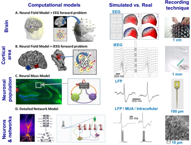 Figure 1. Models of epileptiform activity exemplified in the context of epileptic spikes