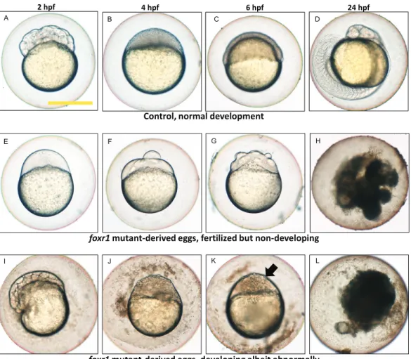 Figure 5 Effect of foxr1 deﬁciency on zebraﬁsh embryogenesis. Representative images demonstrating development of fertilized eggs from crosses between control (A–D) and foxr1 (E–L) females and vasa::gfp males from 2 to 24 h post-fertilization (hpf)