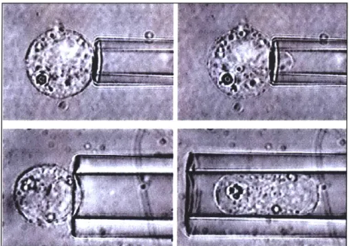 Fig. 2.1: The video-micrograph of a red blood cell drawn into a pipette (Jones et al.,  1999).