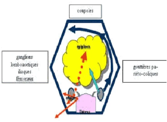Figure : mode d’extension des cancers ovariens. 