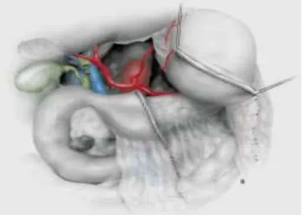 Figure 2: l'estomac est sectionné 