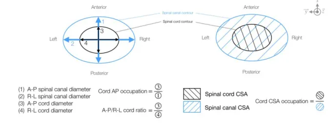 Figure  1.  Definition  of  the  compression  indices  measured  on  anatomical  MRI  data