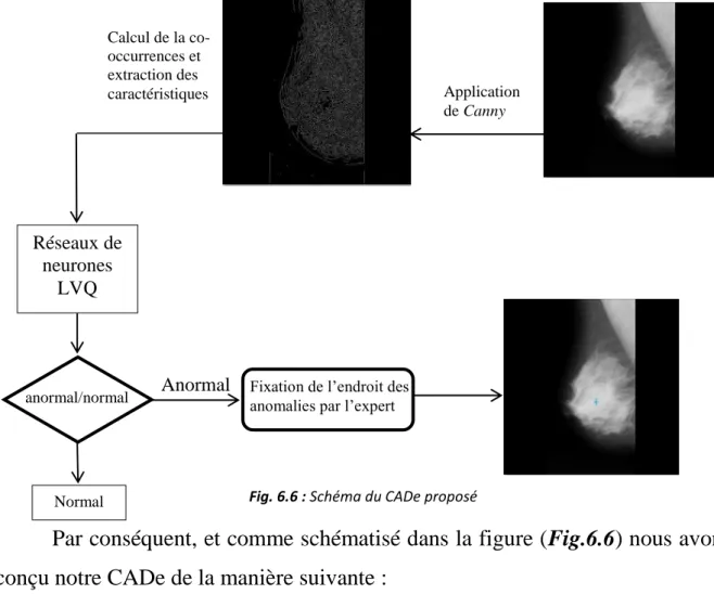 Fig. 6.6 : Schéma du CADe proposé