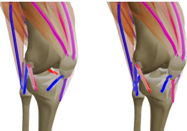Figure 8: Stable biomechanical simulation of the Lachman test us- us-ing our 1D elastic models with stiff unilateral constraints