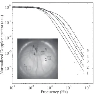 FIG. 11. Local quadratic mean velocity map in the eye fun- fun-dus. Units : mm.s − 1 