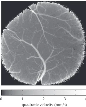 FIG. 8. Map of the local quadratic mean blood flow velocity v F derived from the Doppler maps reported in Fig