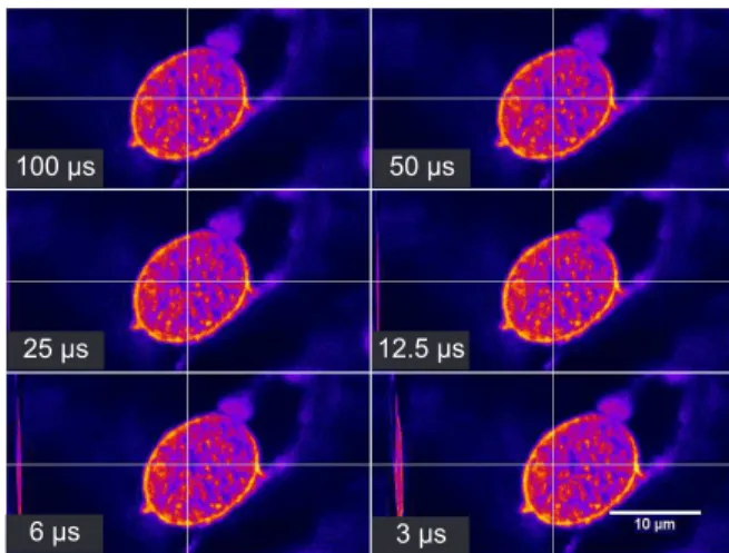 FIG. 4: (Color online) Comparison of several images of a fixed sample acquired with different pixel dwell times (indicated in the corner of each image)