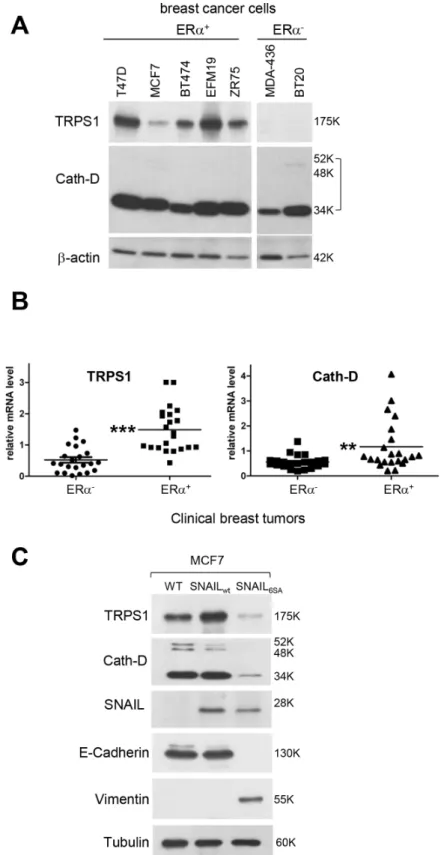 Figure  2:  The  ER  status  and  EMT  influence  Cath-D  and  TRPS1  expression  in  human  BCC  lines  and  breast  tumors