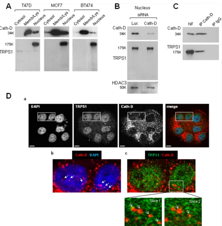 Figure 4: Nuclear interaction and co-localization of endogenous fully-mature Cath-D and full-length TRPS1 in ER + BCC