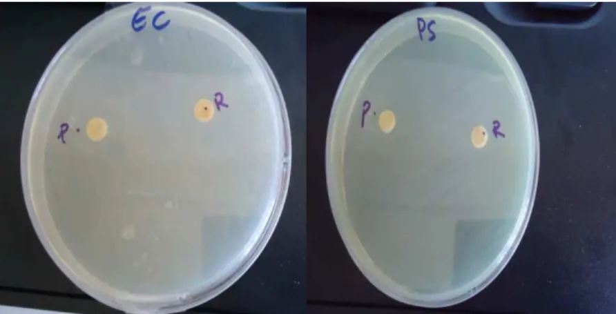 Figure 5. Activité antibactérienne de l’huile  essentielle de la plante vis-à-vis des bactéries à Gram  négatif : à droite : vis-à-vis de Pseudomonas aeruginosa ; à gauche : vis-à-vis d’Escherichia coli 