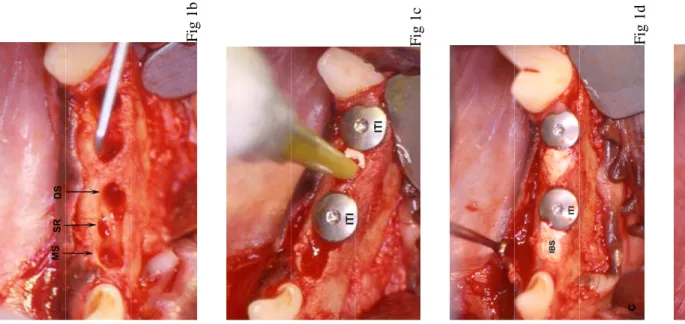 Fig 1b Fig 1c  Fig 1d Fig 1e 